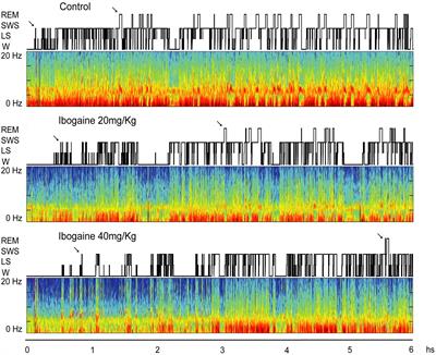 Ibogaine Acute Administration in Rats Promotes Wakefulness, Long-Lasting REM Sleep Suppression, and a Distinctive Motor Profile